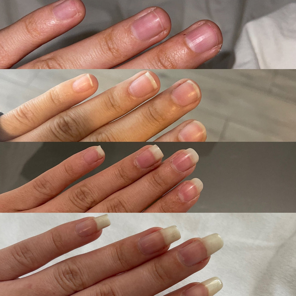ENDURECEDOR DE UÑAS Oferta 3X1 | Uñas largas y fuertes en una semana