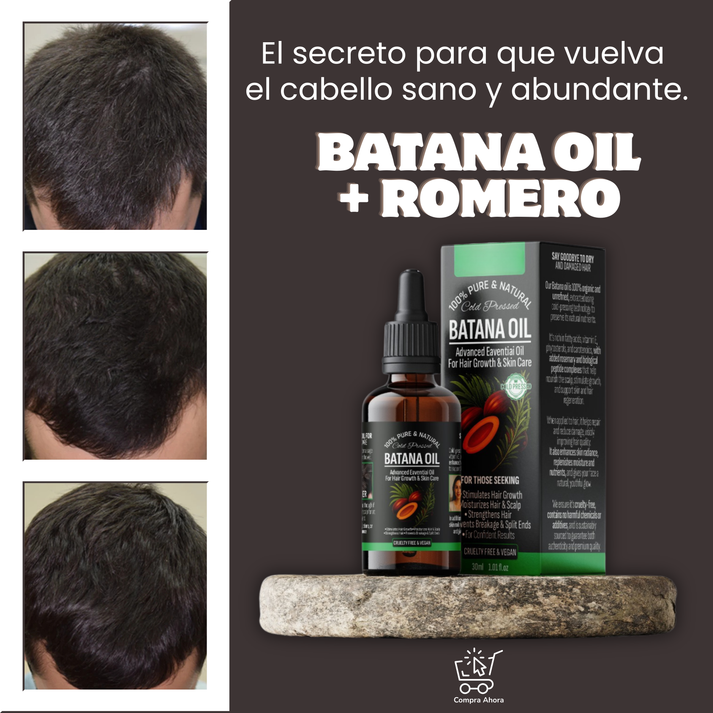Aceite de Batana® | No más caída del cabello, recupera tu confianza