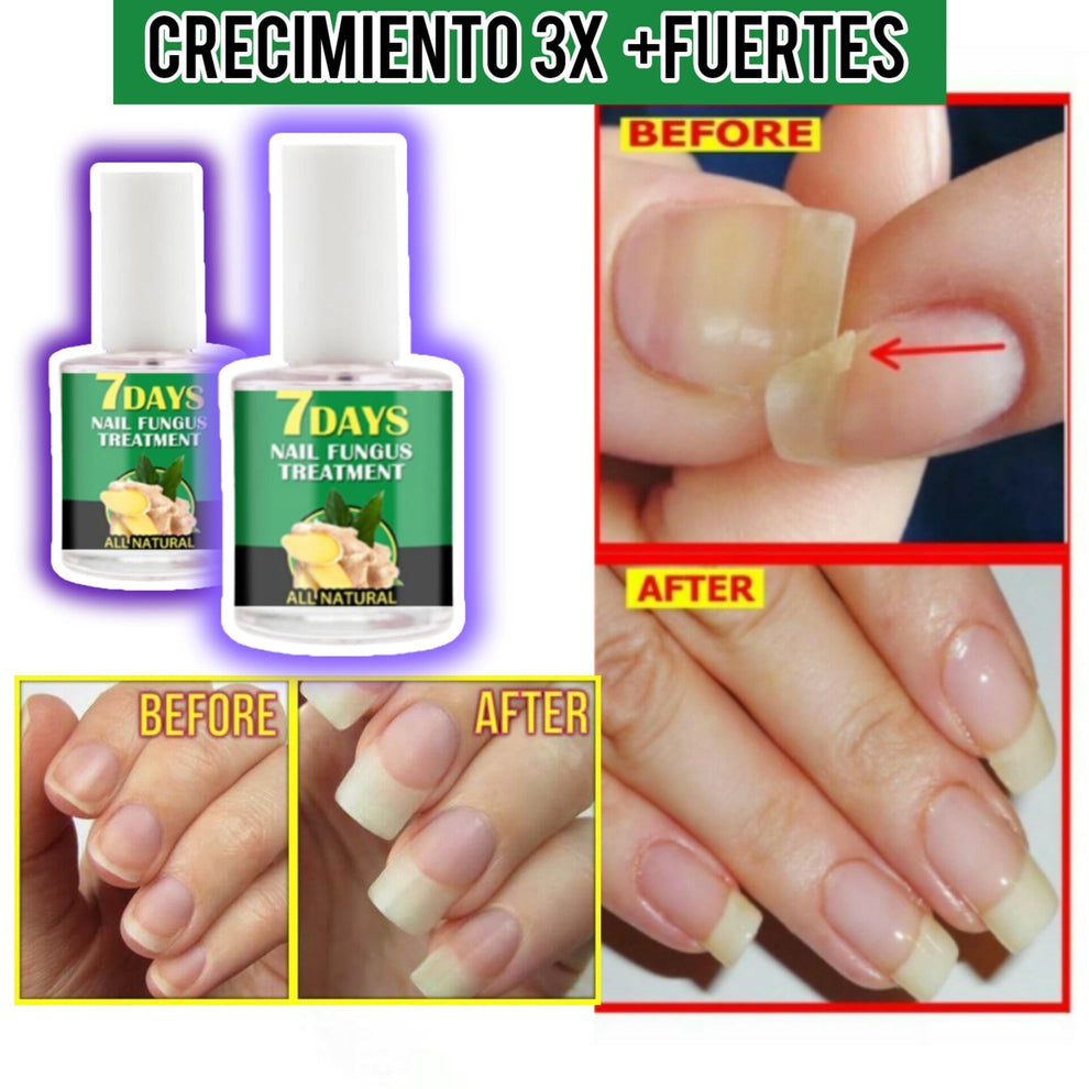ENDURECEDOR DE UÑAS Oferta 3X1 | Uñas largas y fuertes en una semana