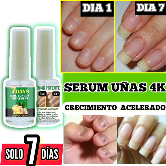 ENDURECEDOR DE UÑAS Oferta 3X1 | Uñas largas y fuertes en una semana